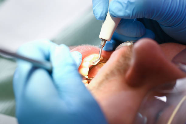 Best Emergency Care for Gum Disease in The Woodlands, TX